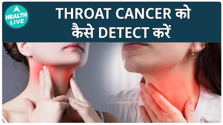 How to Detect and Prevent Throat Cancer Early, Insights from MD Anderson Cancer Center